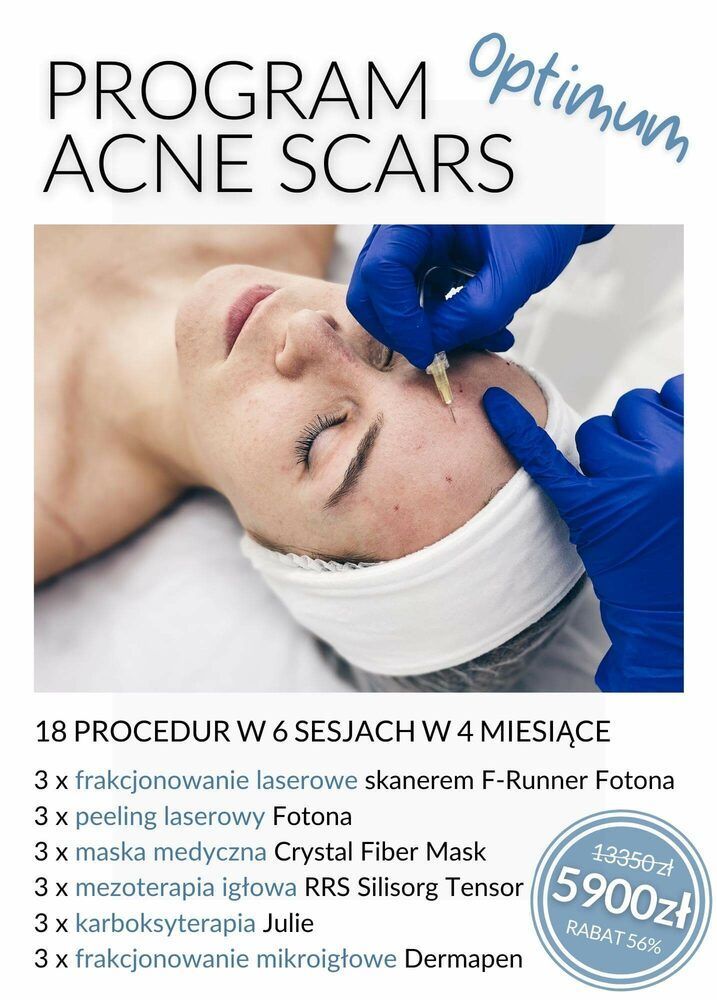 Portfolio usługi Program Acne Scars - OPTIMUM
