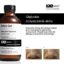 Portfolio usługi PCA Skin  Terapeutyczne oczyszczanie skóry