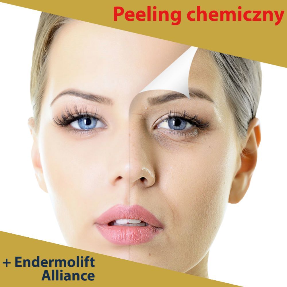 Portfolio usługi Peeling chemiczny + Endermolift Alliance
