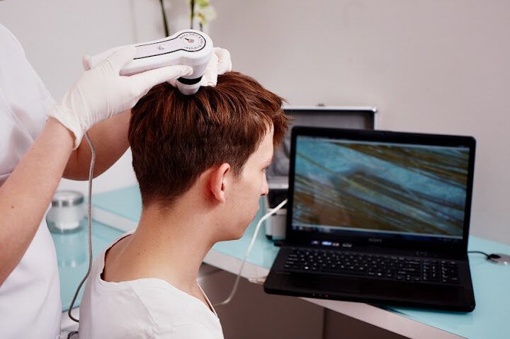 Portfolio usługi Badanie skóry głowy i włosów kamerą
