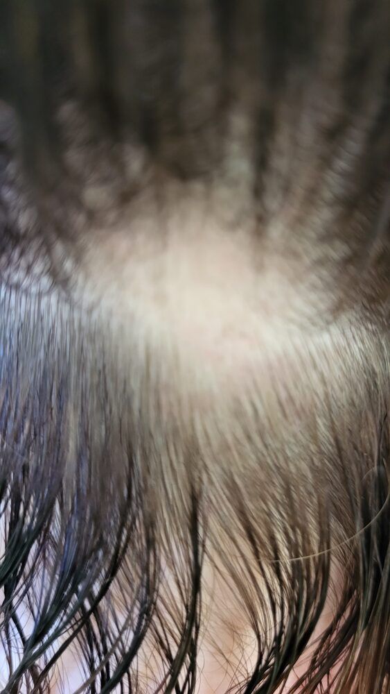 Portfolio usługi BADANIE TRYCHOLOGICZNE skóry głowy i włosów