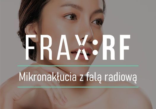 Portfolio usługi Frax:RF - mikronakłucia z falą radiową -  Blizn...