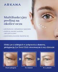Portfolio usługi Eye Complex Care ARKANA
