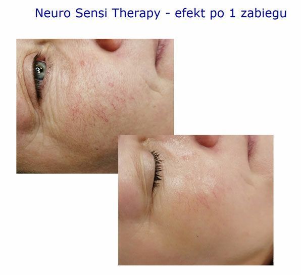 Portfolio usługi Neuro Sensi Therapy Arkana