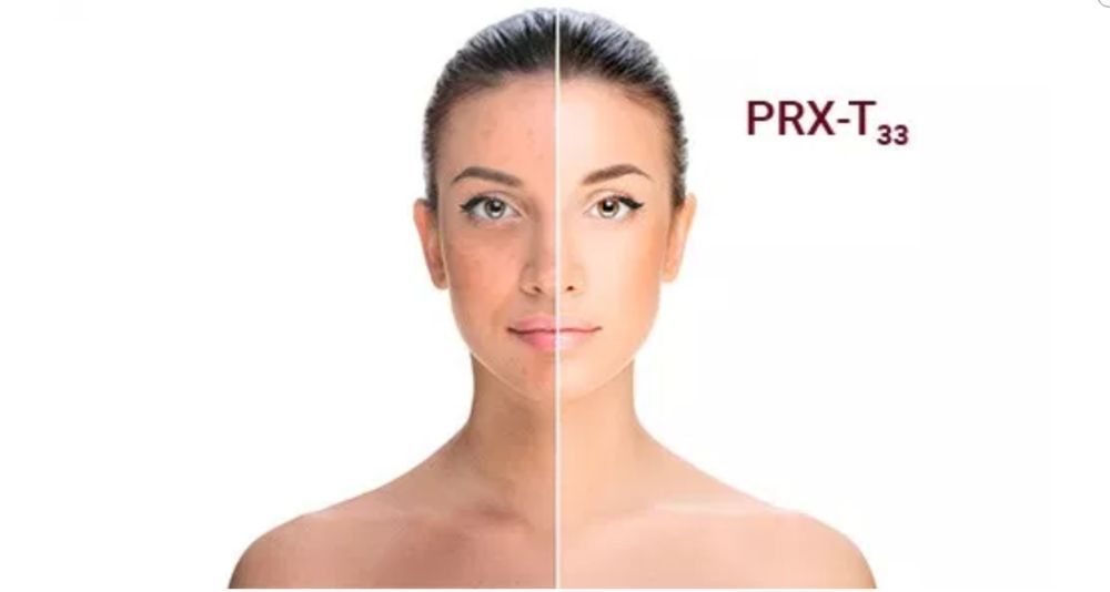Portfolio usługi Peeling PRX-T 33