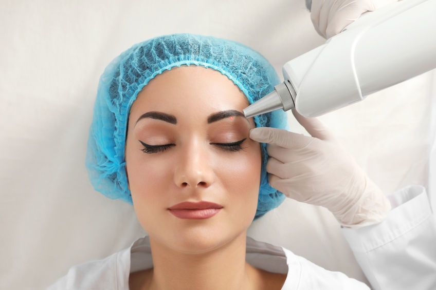 Portfolio usługi Laserowe usuwanie makijażu permanentnego i mikr...