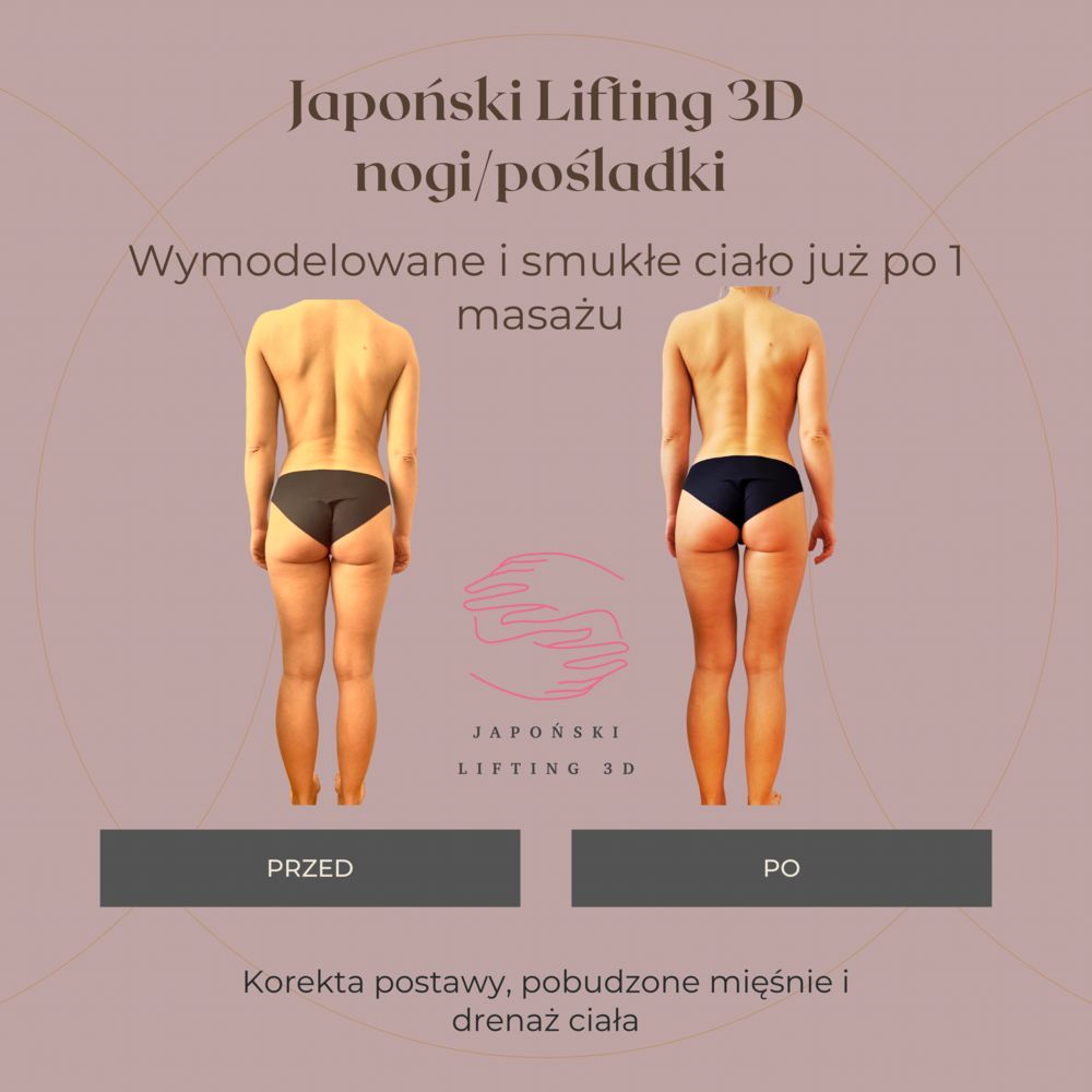 Portfolio usługi Japoński lifting 3D nogi