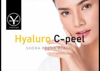 Portfolio usługi Hyaluro C-Peel - silne nawilżanie i witaminizow...
