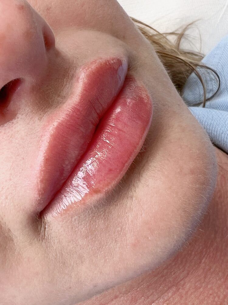 Portfolio usługi Baby Doll Lips - modelowanie ust 1 ml