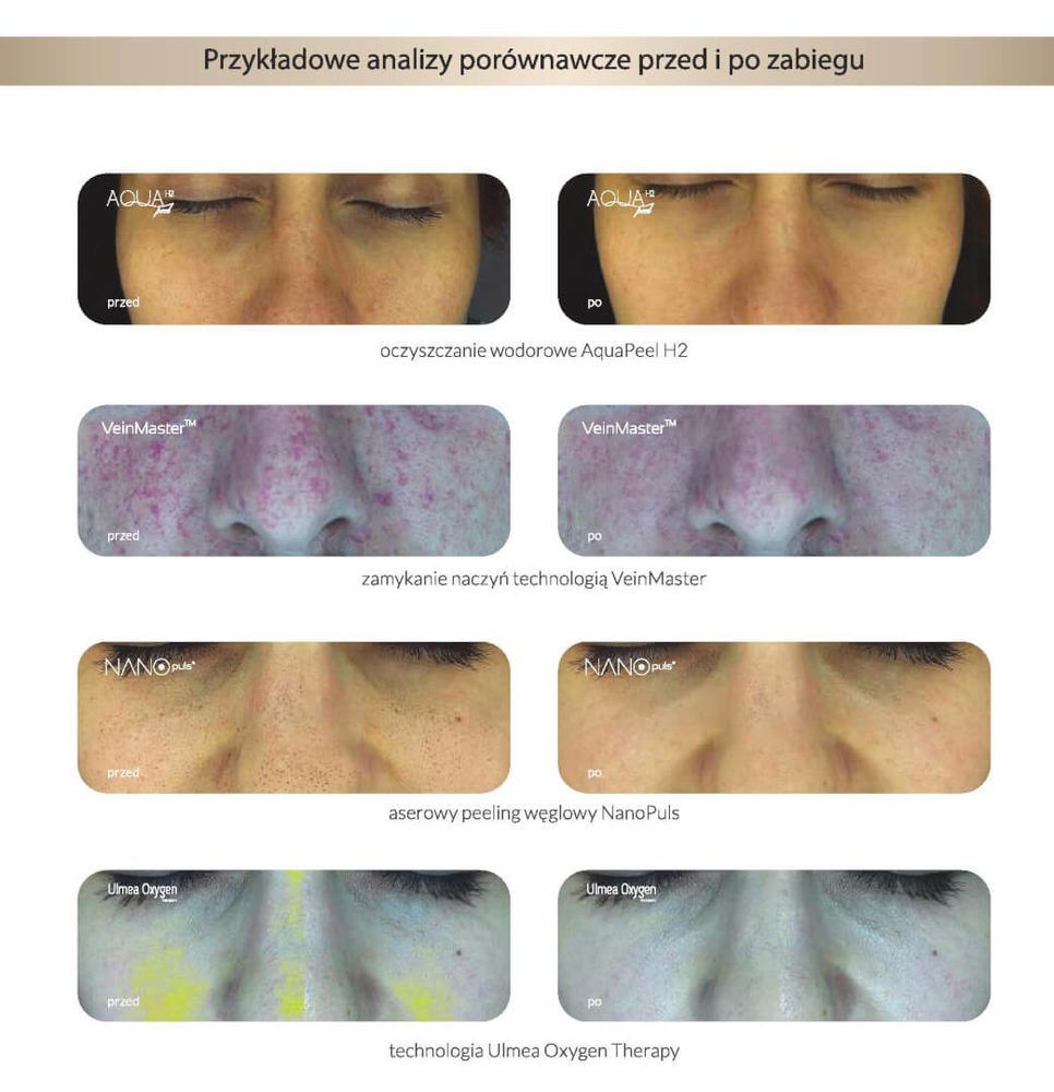 Portfolio usługi Multispektralna diagnostyka skóry twarzy LumiSCAN