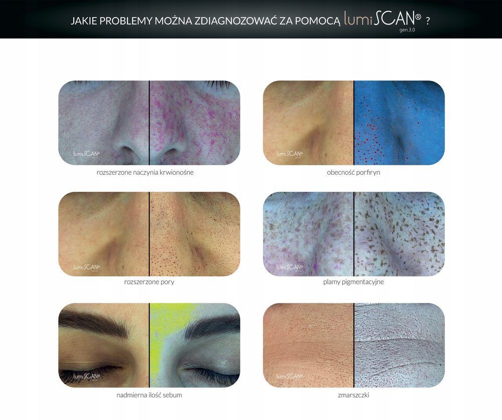 Portfolio usługi Multispektralna diagnostyka skóry twarzy gen. 3.0