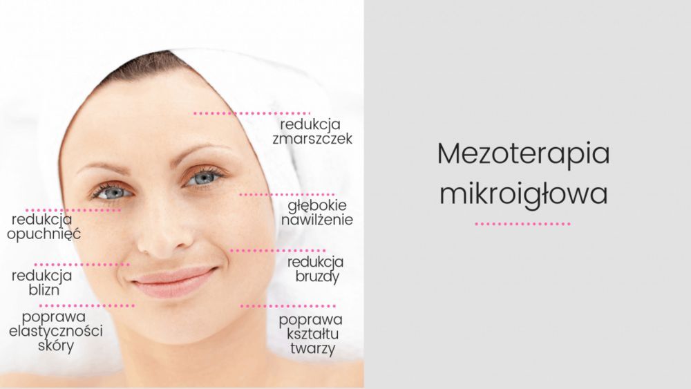 Portfolio usługi Mezoterapia mikroigłowa Dermapen - twarz + szyja