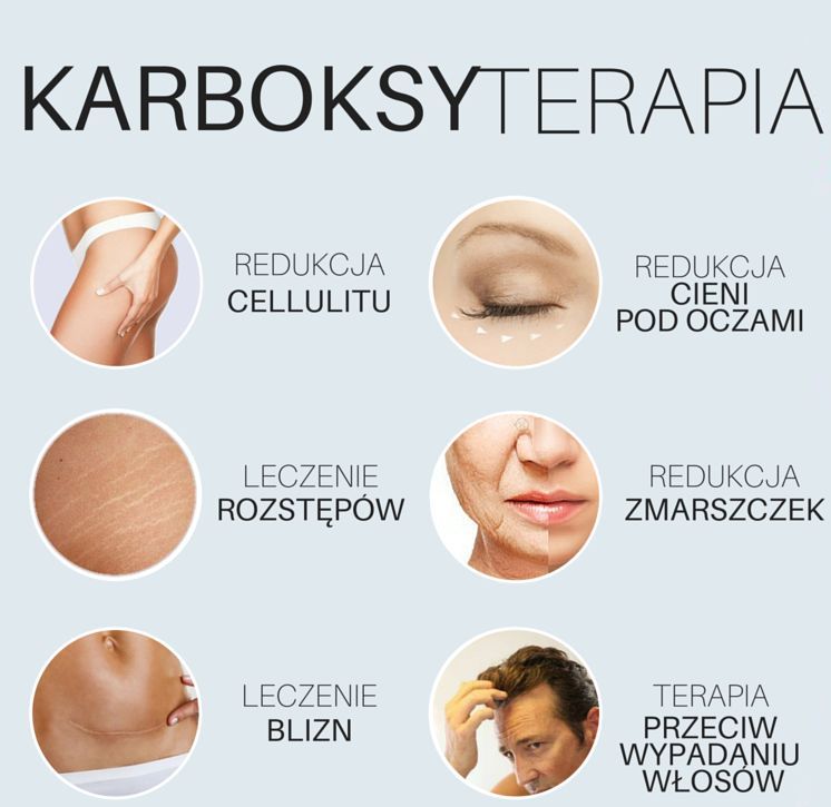 Portfolio usługi Karboksyterapia -  BOCZKI