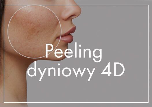 Portfolio usługi Peeling Dyniowy 4D