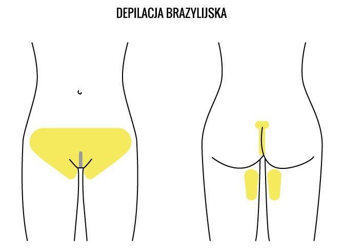 Portfolio usługi Bikini brazyjijskie
