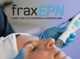 Portfolio usługi Frakcyjna elektroporacja mikroigłowa - fraxEPN