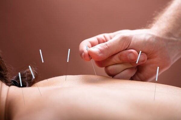 Portfolio usługi Akupunktura – równoważenie wg dra Tana