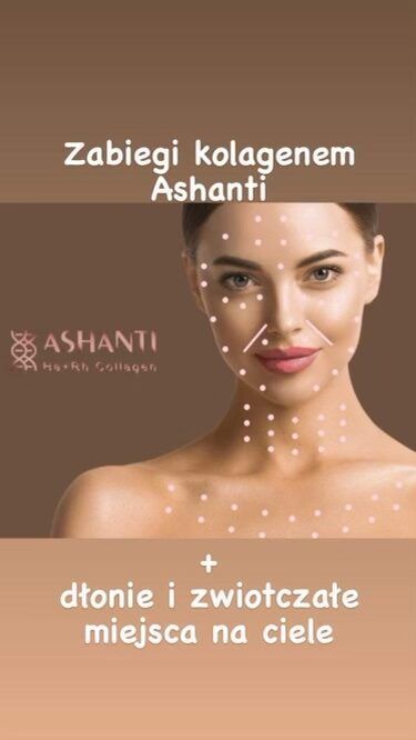 Portfolio usługi Ashanti kolagen - mezoterapia igłowa