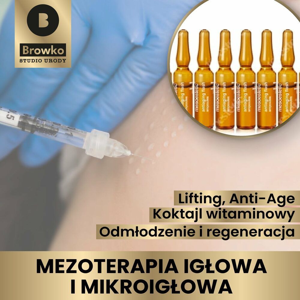Portfolio usługi Mezoterapia igłowa - Twarz+szyja+dekolt