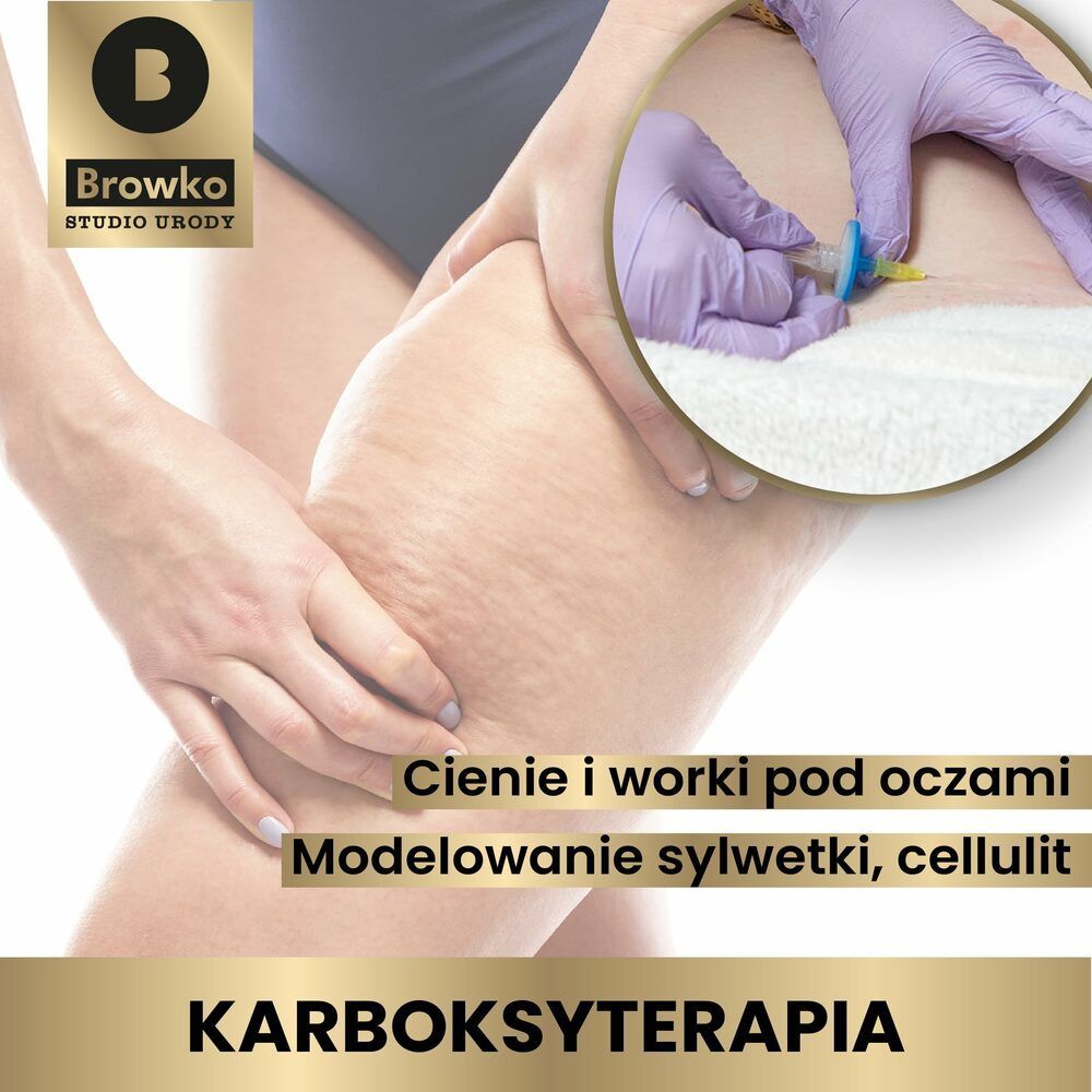 Portfolio usługi Karboksyterapia - Uda + pośladki