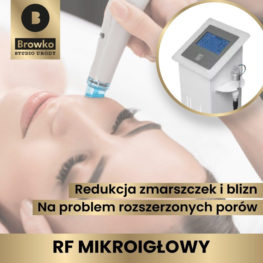 Portfolio usługi Rf MiKroigŁowy - Twarz+szyja+dekolt + Gen Factor