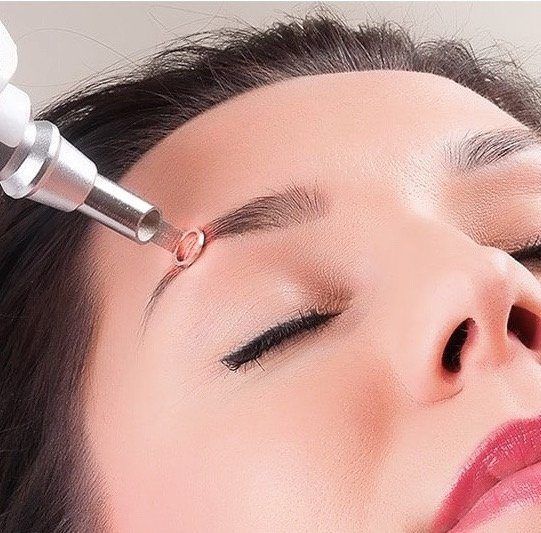 Portfolio usługi Laserowe usuwanie makijażu permanentnego brwi/ust