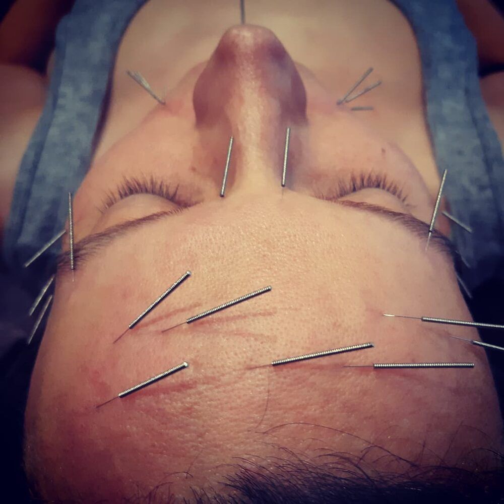 Portfolio usługi Masaż lift up z akupunkturą twarzy