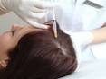 Portfolio usługi Karboksyterapia na owłosioną skórę głowy-seria ...