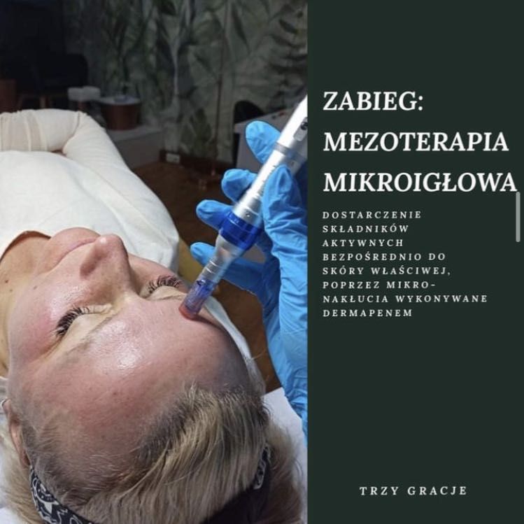 Portfolio usługi Mezoterapia mikroigłowa (dermapen)