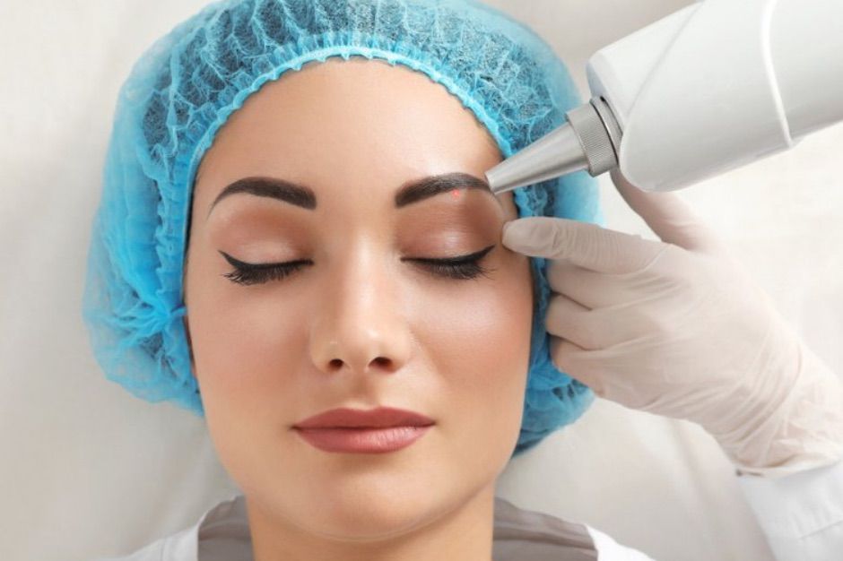 Portfolio usługi Laserowe Usuwanie Makijażu Permanentnego Brwi