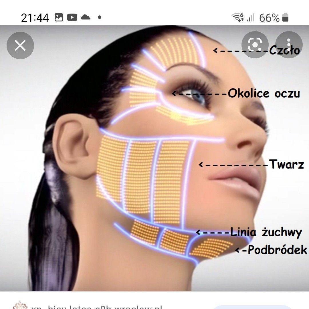 Portfolio usługi Hifu 3D twarz podbródek linia żuchwy