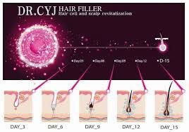 Portfolio usługi Dr.CYJ Hair Filler
