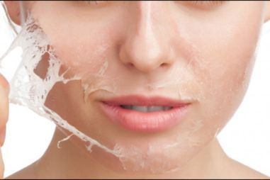 Portfolio usługi Peeling kwasem TCA twarz, szyja i dekolt