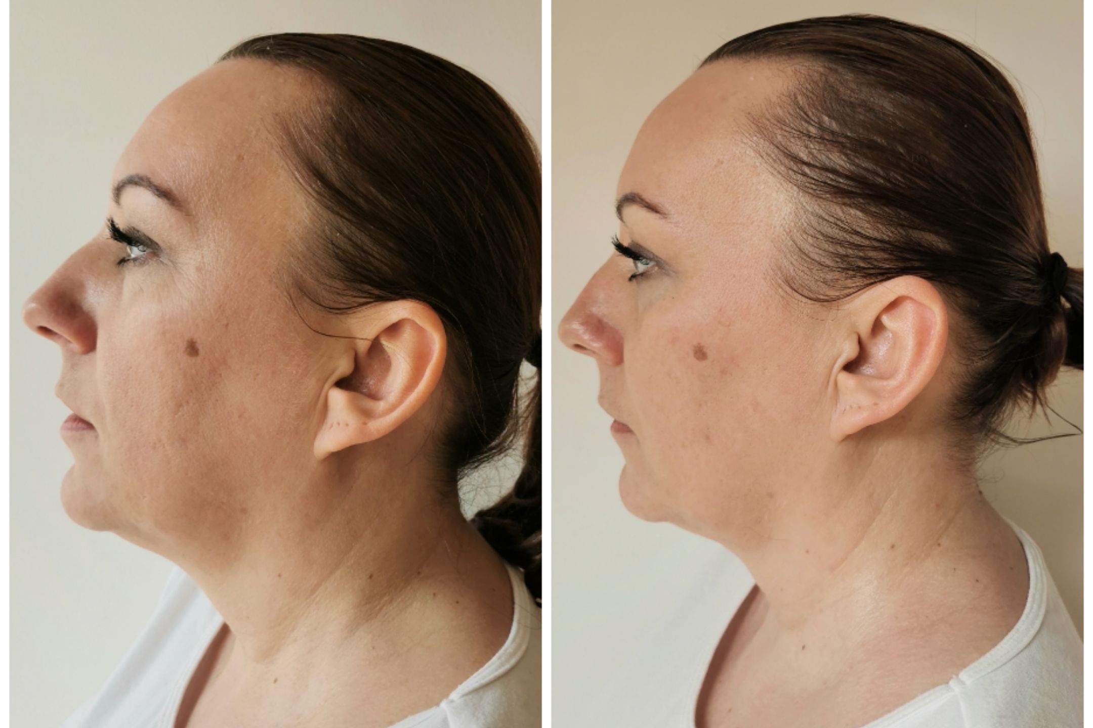 Portfolio usługi Holistyczny masaż twarzy