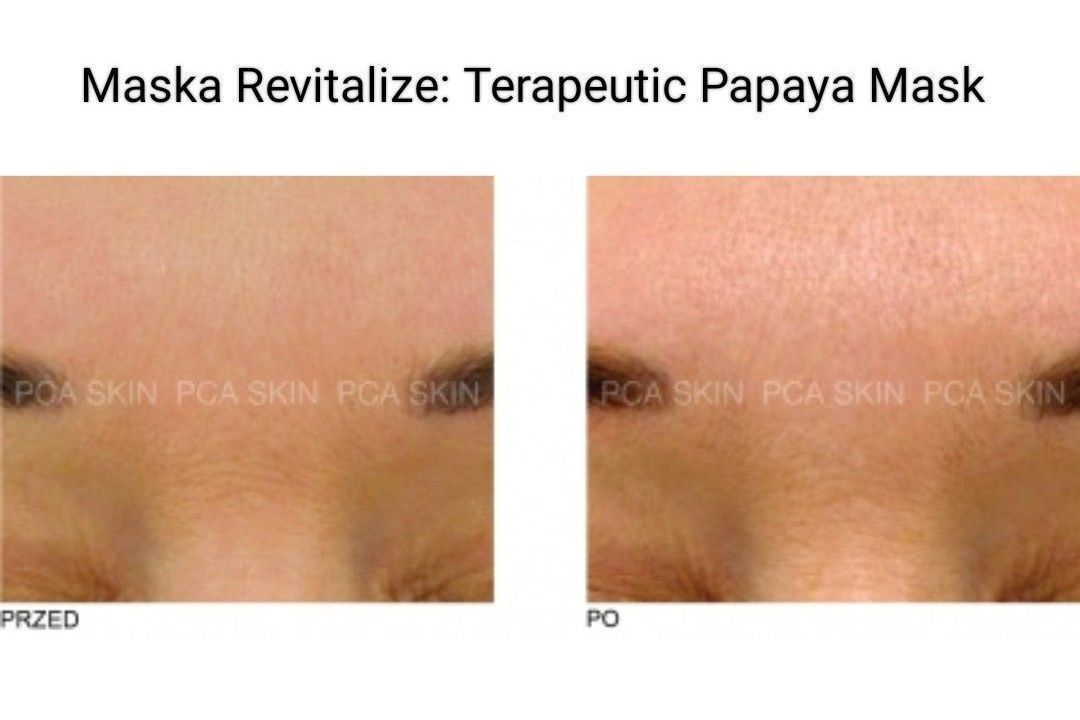 Portfolio usługi Detoxifying Pore Treatment + maska PCA