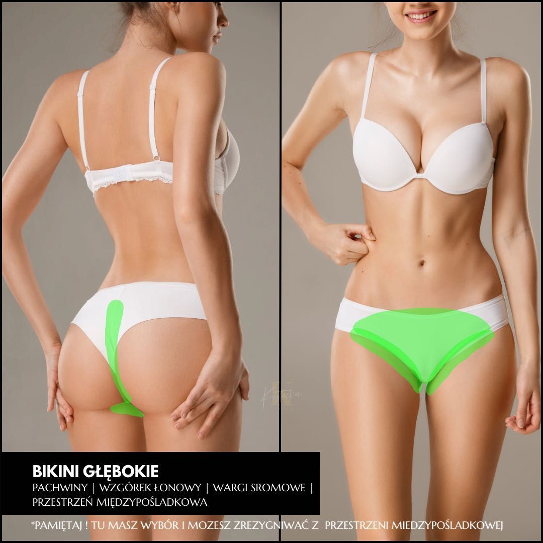 Portfolio usługi Bikini głębokie  - depilacja laserowa