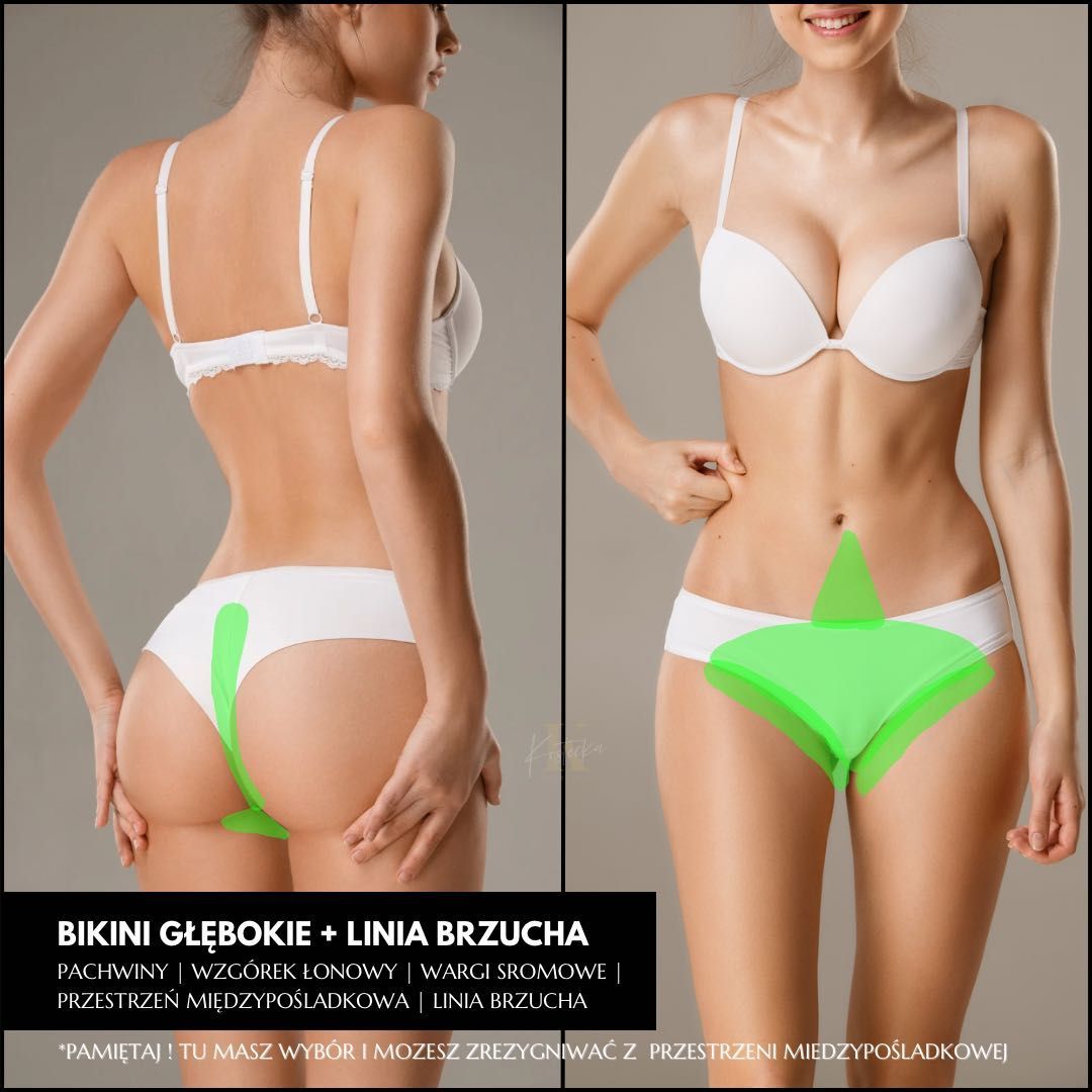 Portfolio usługi Bikini głębokie + linia brzucha depilacja laserowa