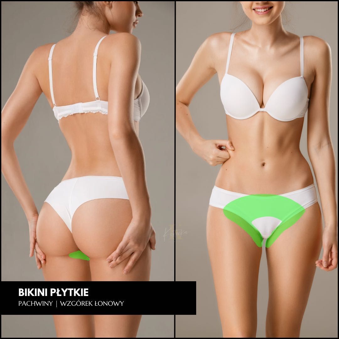 Portfolio usługi Bikini płytkie - depilacja laserowa