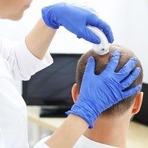 Portfolio usługi Analiza stanu skóry głowy + Peeling