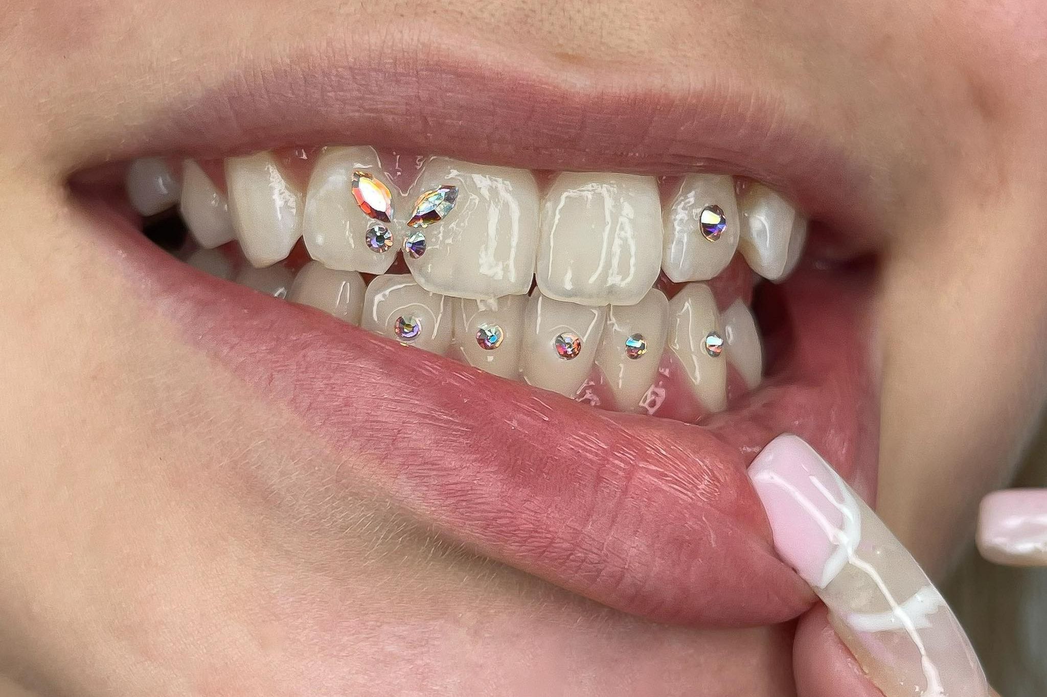 Portfolio usługi Tooth gems