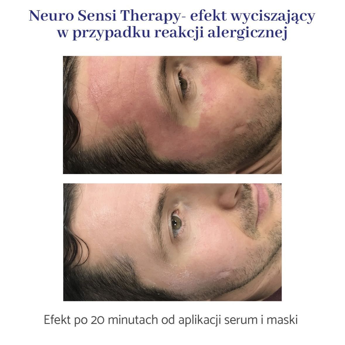 Portfolio usługi Neuro Sensi Therapy