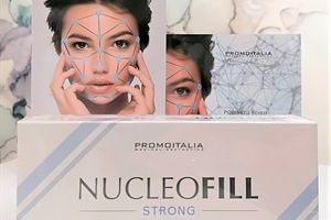 Portfolio usługi Nucleofill - 1 zabieg (twarz lub inna okolica)