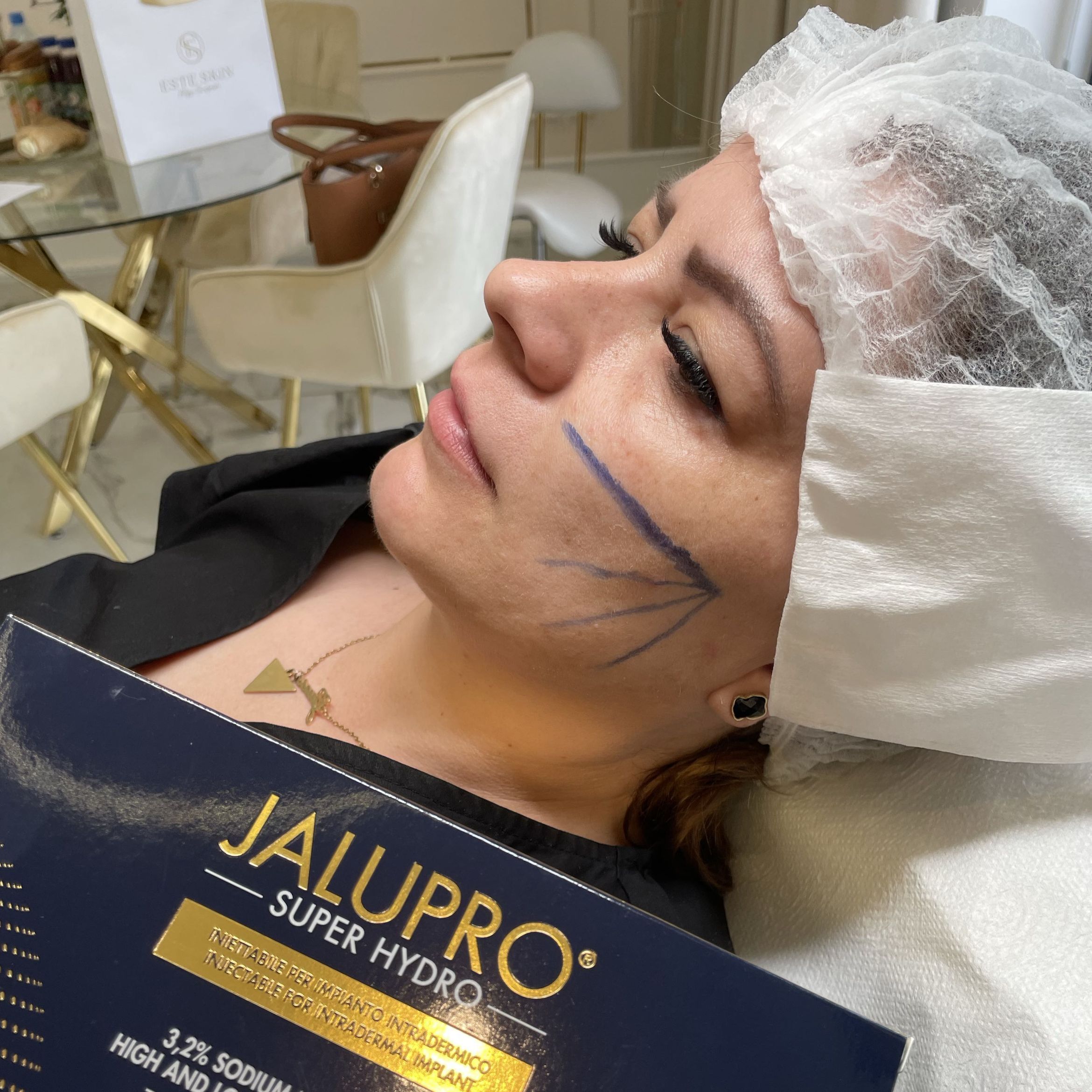 Portfolio usługi Stymulatory tkankowe Jalupro