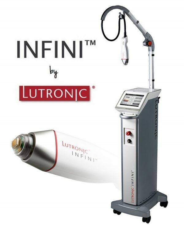 Portfolio usługi RF mikroigłowy Infini Lutronic twarz