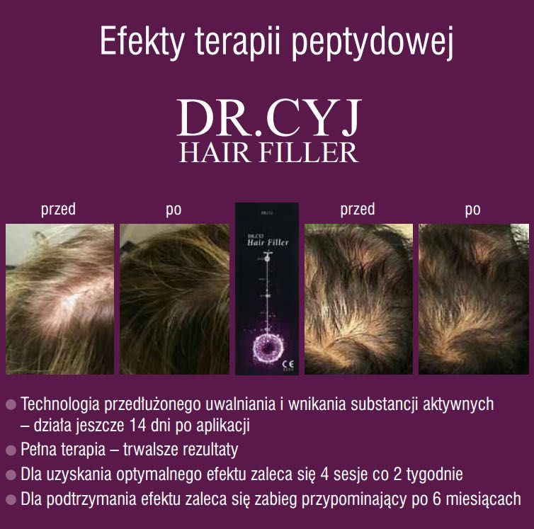 Portfolio usługi Terapia DR. CYJ Hair 1ml - Głowa
