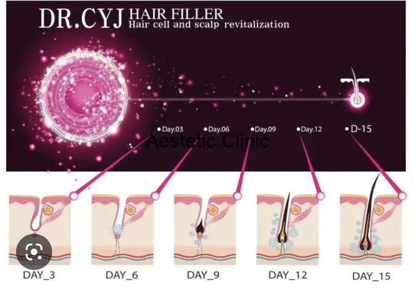 Portfolio usługi Dr. Cyj peptydowa terapia włosów
