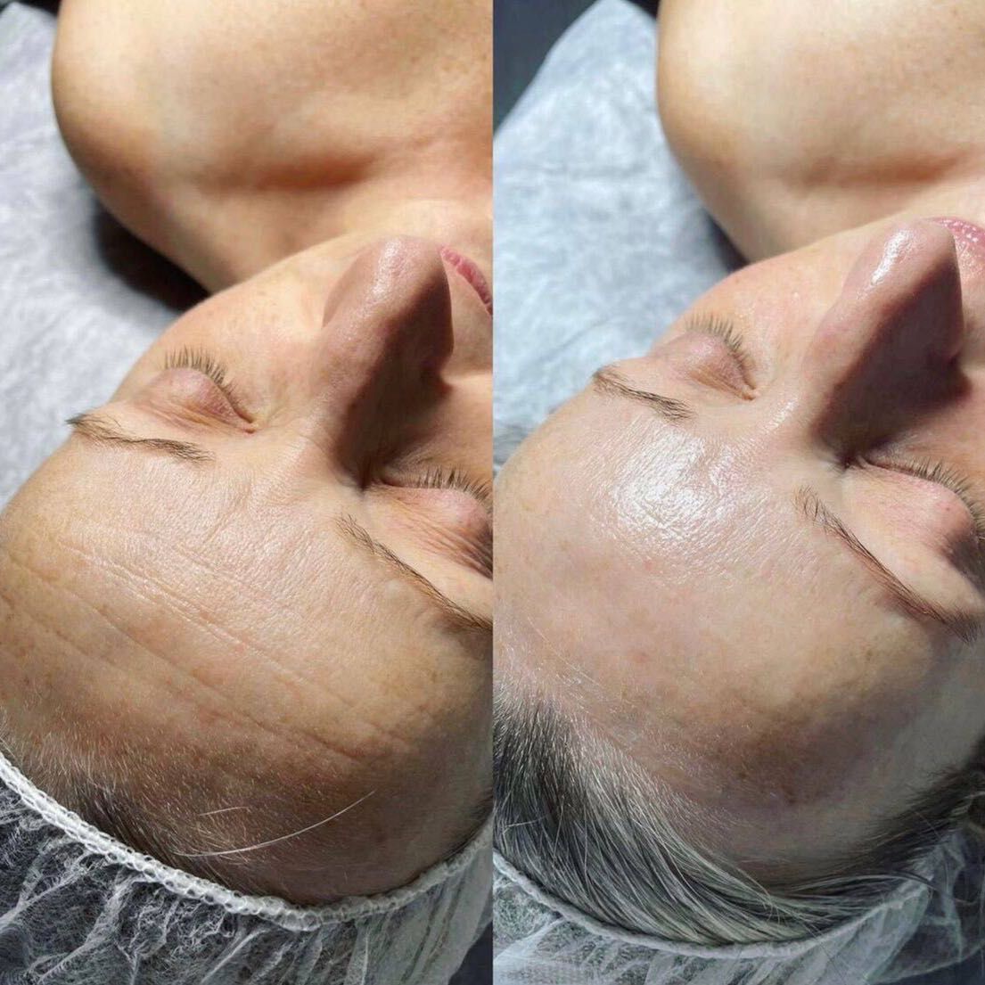 Portfolio usługi Masaż twarzy Mioplastyczny