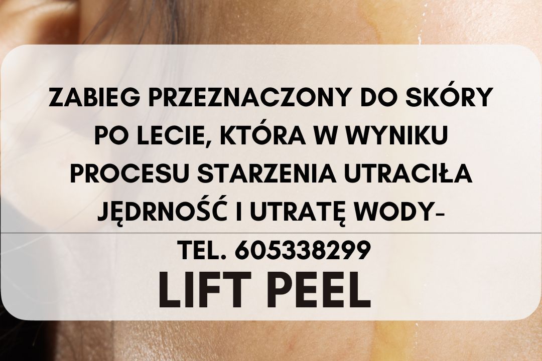 Portfolio usługi Odmładzanie twarzy LIFT PEEL - rewolucja cenowa