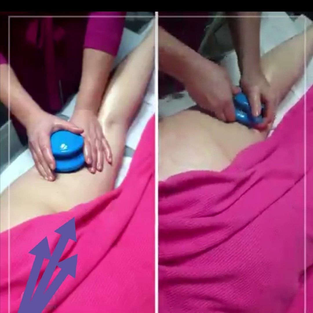 Portfolio usługi Antycellulitowy masaż bańką chińską