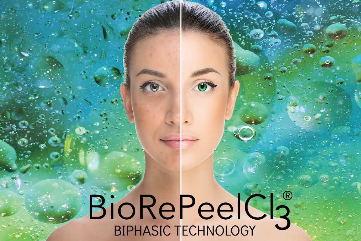 Portfolio usługi Peeling BioRePeelCl3